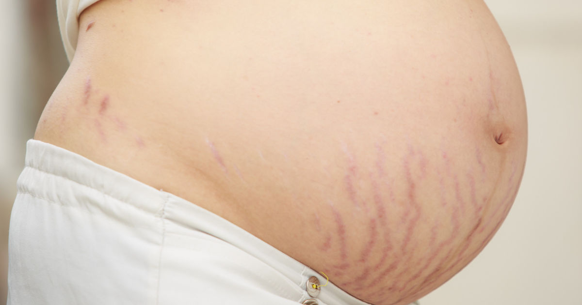 Postpartum Abdominal and Hip Fissure Treatment